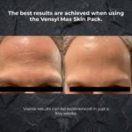 Vensyl Max Skin Pack férfi arcápoló csomag, arclemosó, arcszérum és arckrém szett, teljes arcápolási rutin, minden bőrtípusra, férfi kozmetikum - Image 7