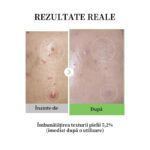 Medicube arcápoló esszencia érzékeny bőrre Centella Asiaticával, segít csökkenteni a bőrpírt és a pattanásokat, alacsony stimulációjú, hidratáló, nyugtató, 30ml - Image 5