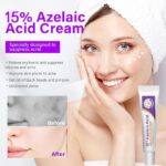 Nyugtató gél 15% azelainsav esszenciával, 20g - Image 2